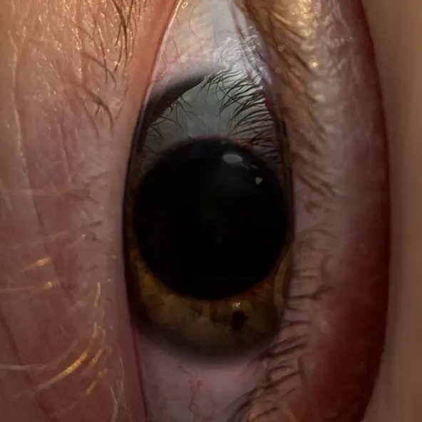 Музика Минаева - Шоколадка (Hostro & Anton Abramov Remix)